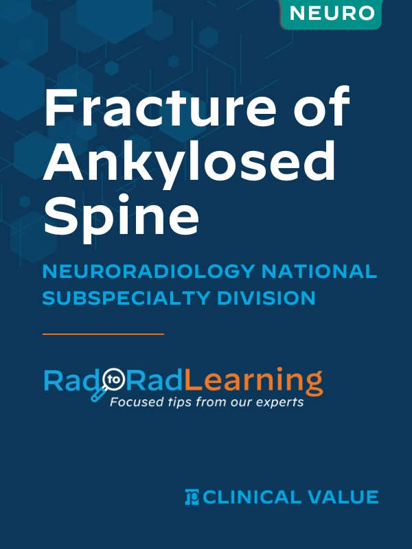Fracture of Ankylosed Spine