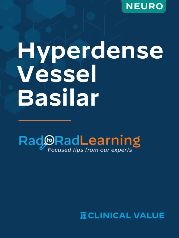 Hyperdense Vessel Basilar