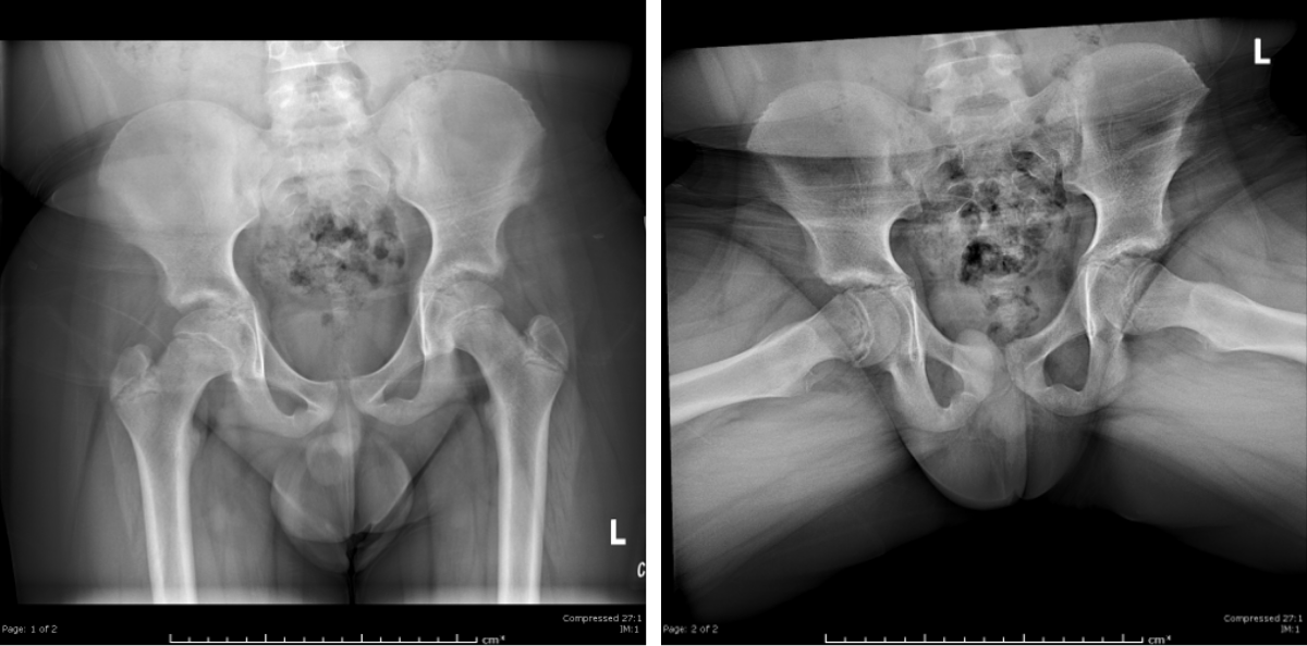 radiographic image of the pelvis