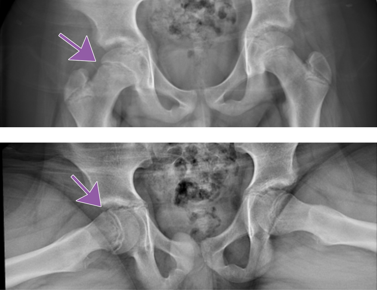 radiographic image of the pelvis