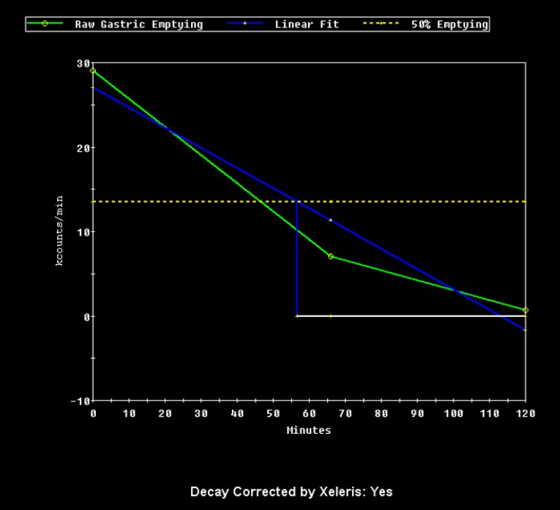 A graph showing gastric emptying over 120 minutes with raw and linear fit lines, and a dashed line for 50% emptying. The x-axis is time in minutes; the y-axis is counts per minute. Text below states Decay Corrected by Xeleris: Yes..