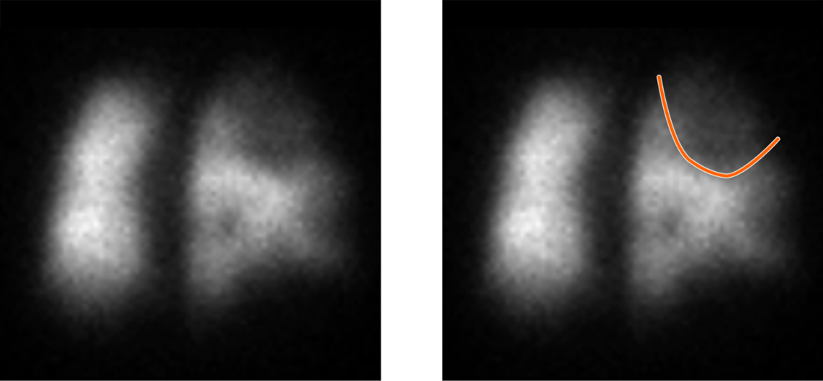 Two blurry grayscale images side by side show vague shapes. The right image has an orange curved line drawn over its upper right area, while the left image has no markings, illustrating a typical scenario in Rad to Rad Learning visualizations.